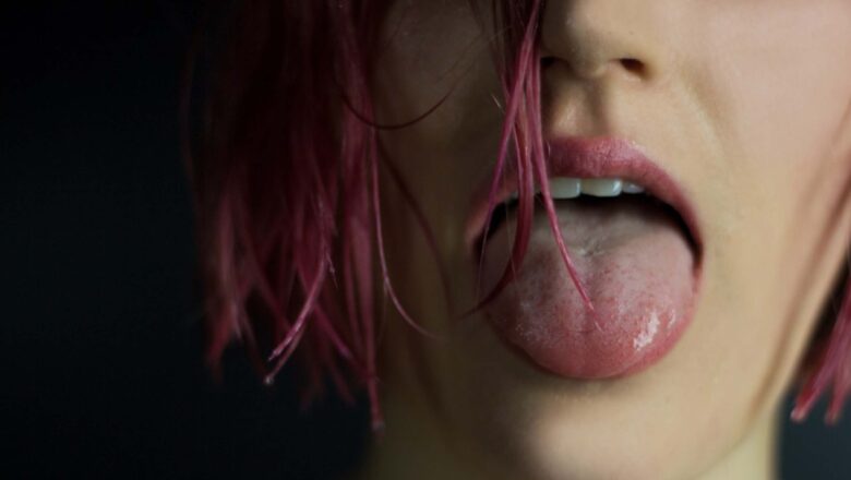 SÍNDROME DE RAPUNZEL: MÉDICOS SALVARON A NIÑA QUE SE ARRANCABA Y TRAGABA EL PELO COMPULSIVAMENTE