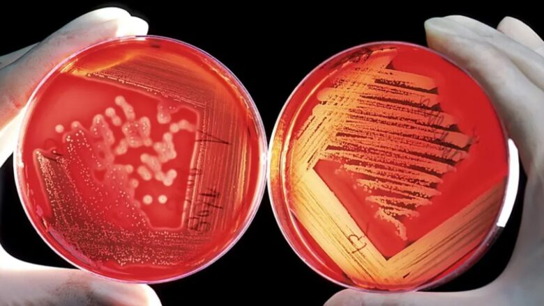 39 MILLONES DE PERSONAS PODRÍAN MORIR HASTA 2050 POR ESTA RAZÓN