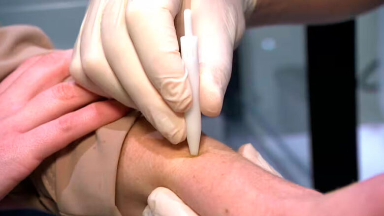 NUEVA PRUEBA INDOLORA DETECTARÍA EN SEGUNDOS UN TIPO DE CÁNCER MUY COMÚN
