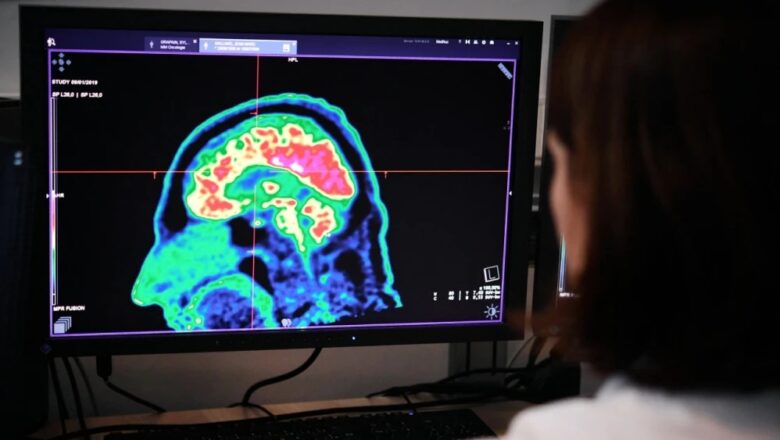 MÁS RÁPIDO QUE UN PARPADEO: ASÍ PROCESA EL LENGUAJE SU CEREBRO