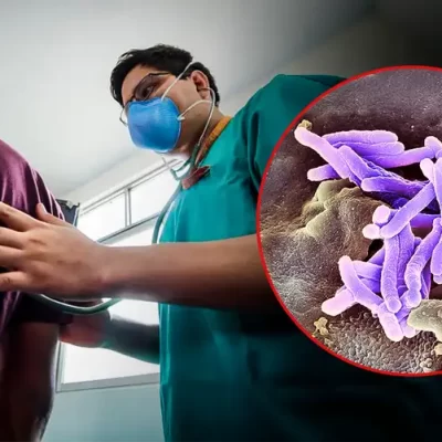 FALTA DE MEDICINAS EXPONE A PACIENTES CON TBC RESISTENTE A GRAVES SECUELAS