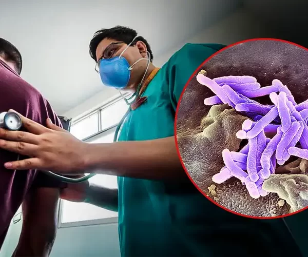 FALTA DE MEDICINAS EXPONE A PACIENTES CON TBC RESISTENTE A GRAVES SECUELAS